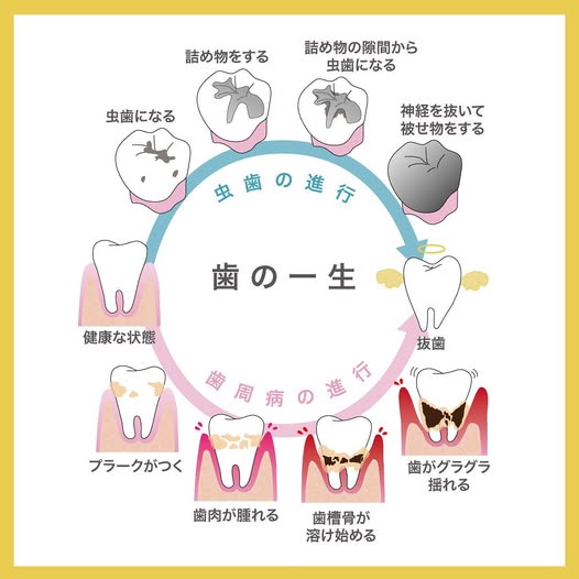 予防歯科