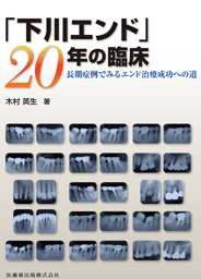 インプラント